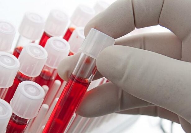 кръвен тест след употреба на алкохол